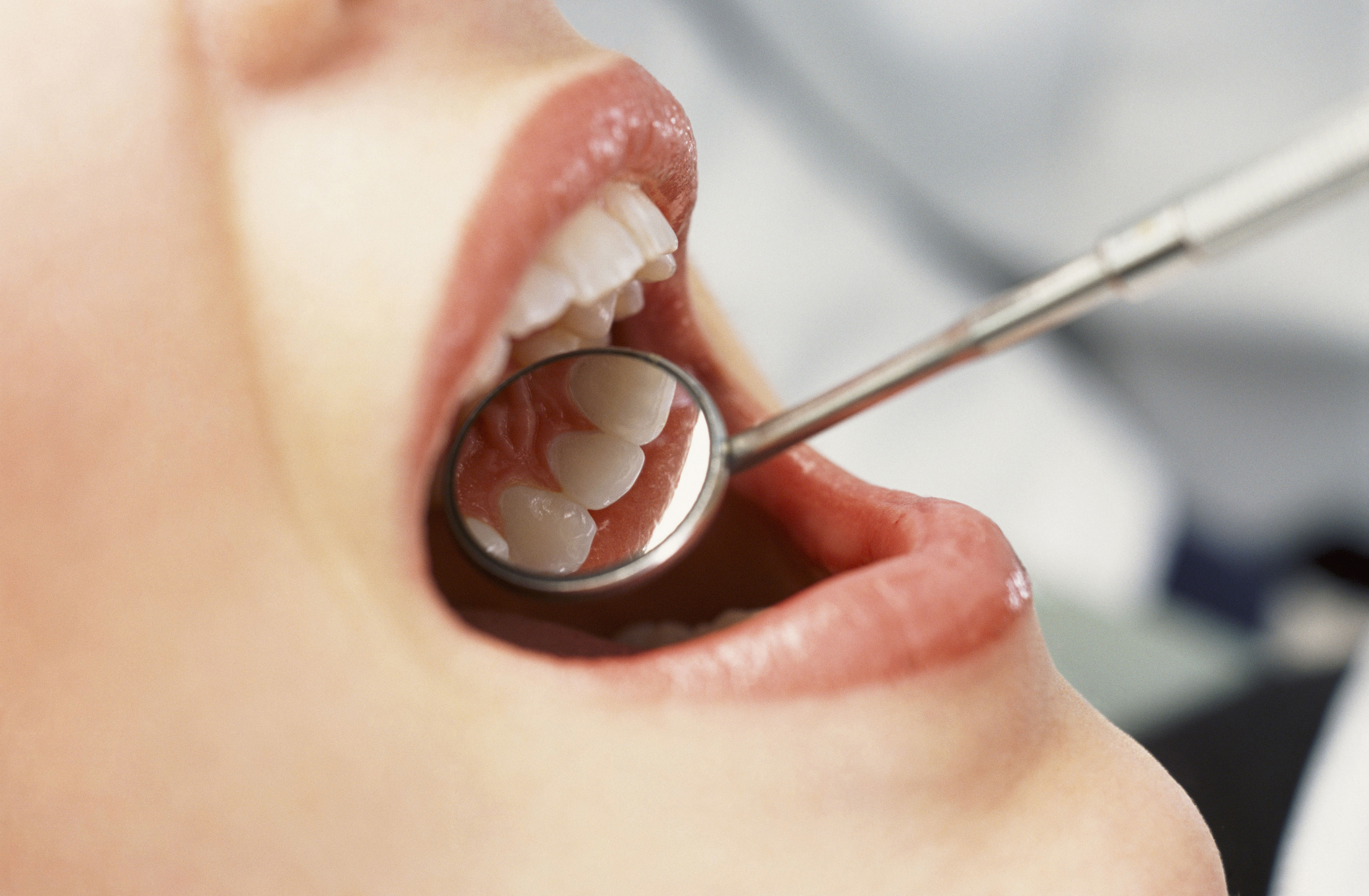 Kompleksinis dantų gydymas